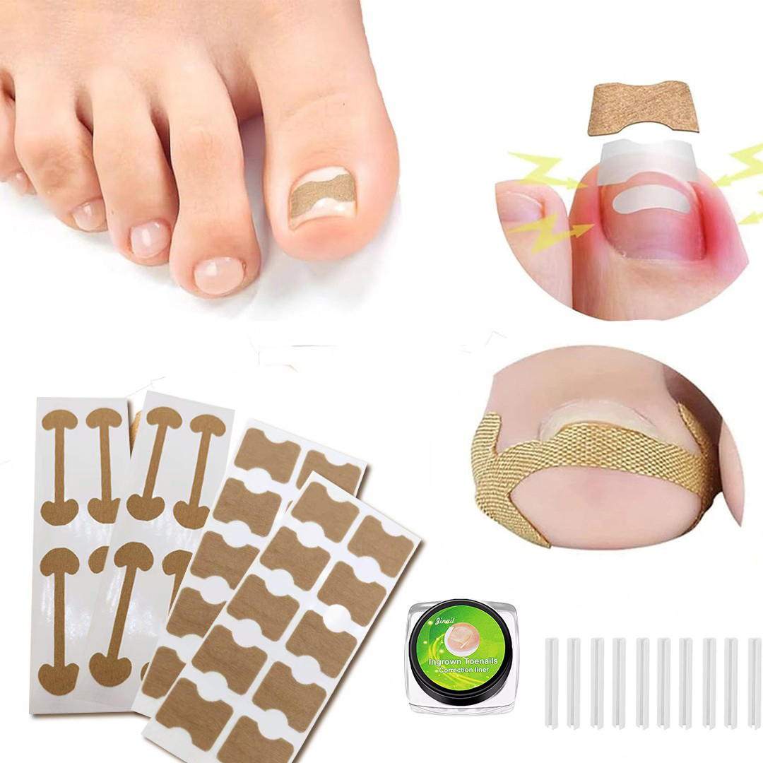 20PCS TOENAIL CORRECTION ADHESIVE PATCH